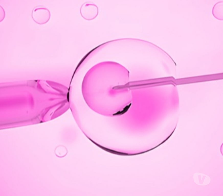 Other Services Hyderabad - Photos for Assisted Hatching &IVF Treatment