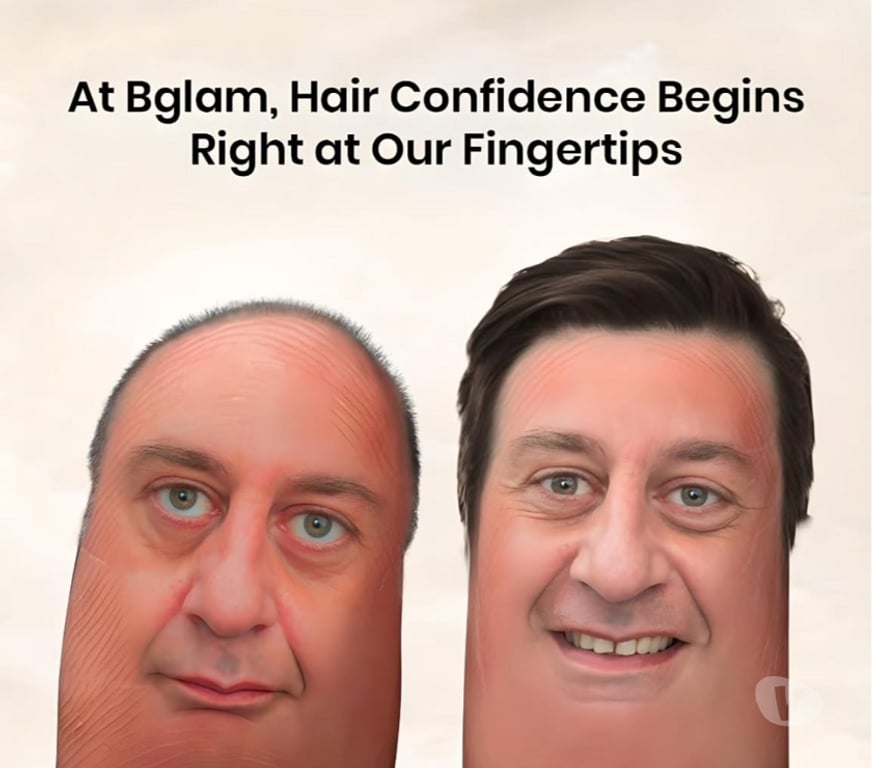 Other Services Bangalore - Photos for Bangalore - Bglam Hair Studio for all Non surgical Hair
