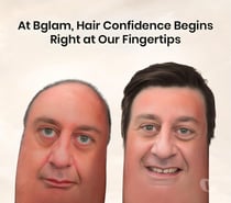 Bangalore - Bglam Hair Studio for all Non surgical Hair